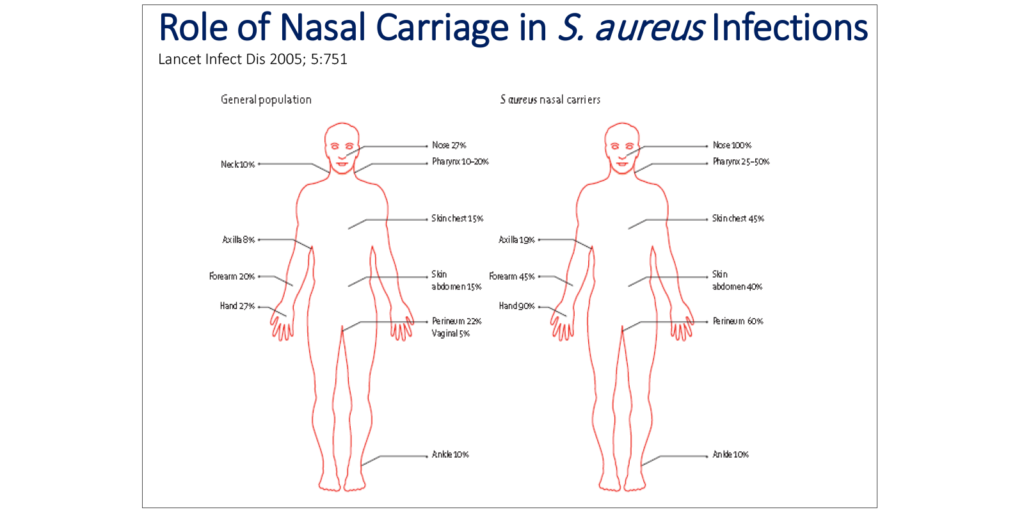 Decolonization to Prevent Infection CE Webinar